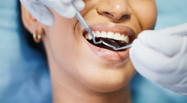 Best Emergency Dental Care for Sports Injuries in Kemmerer, WY